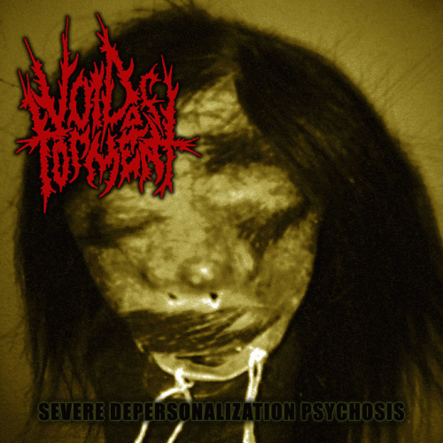 Severe Depersonalization Psychosis